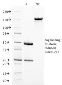 Data from SDS-PAGE analysis of Anti-gp100 antibody (Clone PMEL/2038). Reducing lane (R) shows heavy and light chain fragments. NR lane shows intact antibody with expected MW of approximately 150 kDa. The data are consistent with a high purity, intact mAb.